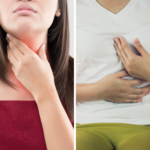 Sizin Reflü Türünüz Hangisi?