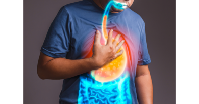 refluyu onleme yollari