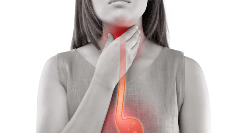 laringofaringeal reflu